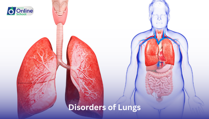 Lesson 09: Disorders of Lungs